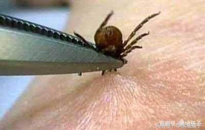 蜱虫是什么，被蜱虫咬伤为什么会丧命？不知道这两点，夏天很危险
